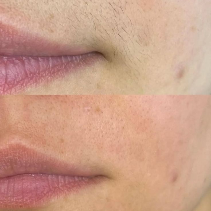 szortelenito_ellotte_utana