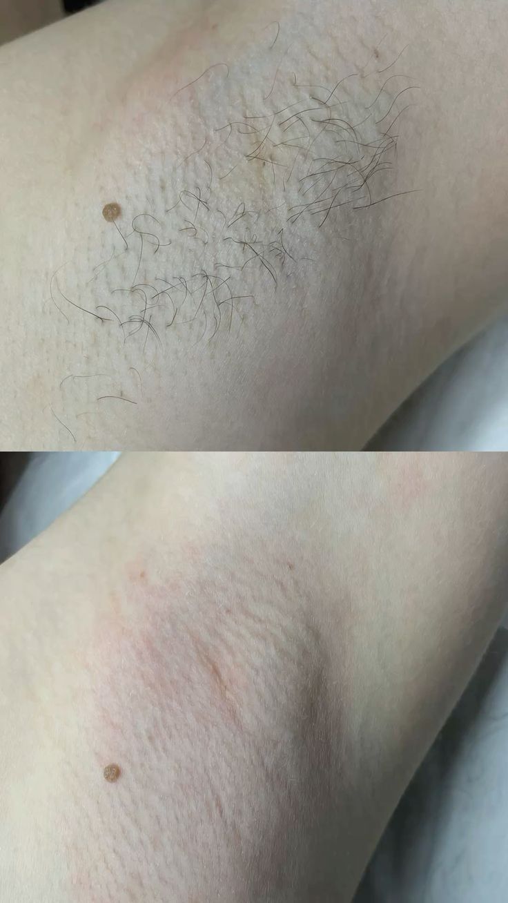 szortelenito_ellotte_utana2