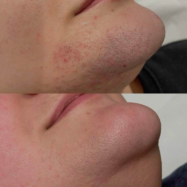 szortelenito_ellotte_utana3